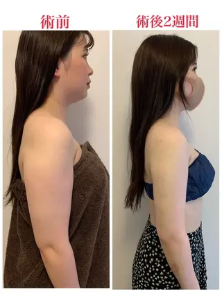 メディカル インディバサロン同心のエステ・リラクイメージ