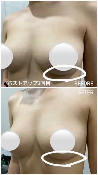 毛穴洗浄・痩身・脱毛 /アルカンジュのエステ・リラクイメージ