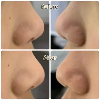 キッズ NARIS BEAUTY STATION デ･アイム札幌白石所属・高岸 利奈のエステ・リラクイメージ