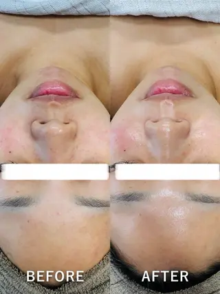 LukeBeauty salonのエステ・リラクイメージ