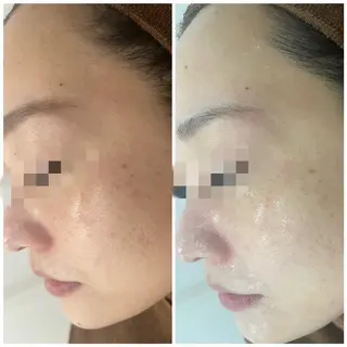 カラー パーマ ヘアアレンジ メンズ キッズ ネイル マツエク・マツパ アイブロウ Amaryllis 🌹のエステ・リラクイメージ