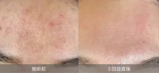 GrandAzure 大人の肌改善のエステ・リラクイメージ