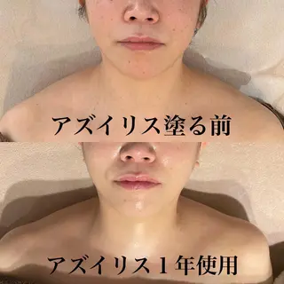 private salon  Dea_maris シュガーリング＆パーソナルボディケア所属・シミ改善・韓国肌管理 ボディメイク痩身のその他イメージ