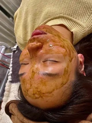 美容鍼灸サロン mahoroba院長のエステ・リラクイメージ