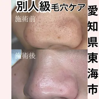 トータルビューティー サロンLilyのエステ・リラクイメージ