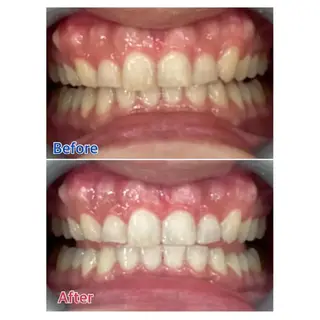 M渋谷店所属・Ｍ渋谷 ホワイトニングのエステ・リラクイメージ