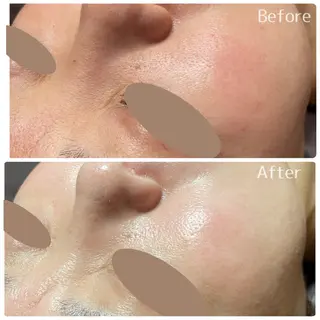 Lutan Richeさいたま店所属・ルタンリッシュ さいたま店のエステ・リラクイメージ