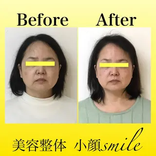 【小顔・姿勢矯正】 美容整体 SMILEのエステ・リラクイメージ