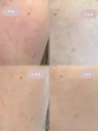 hairsalon&eyelash Jill所属・Jill Erikaのエステ・リラクイメージ