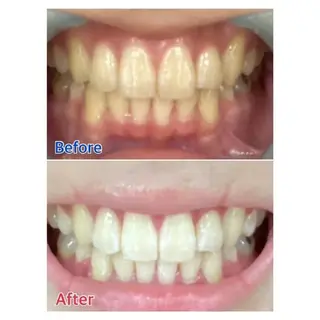 M渋谷店所属・M渋谷 ホワイトニングのエステ・リラクイメージ