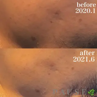 浜野 恵美のエステ・リラクイメージ