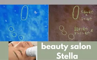beautysalon　Stella所属・【稲毛】毛穴改善専門 Stellaのその他イメージ