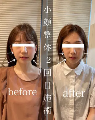 鍼灸整骨院Refine所属・鍼灸 Refineのその他イメージ