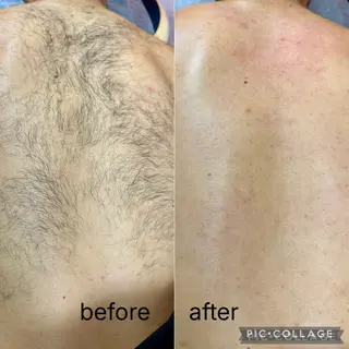 メンズ Laki wax所属・Laki wax chikaのエステ・リラクイメージ