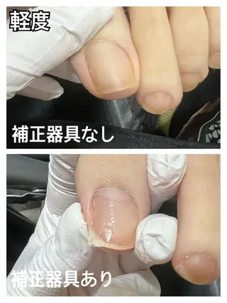 ネイル 巻き爪補正店 堺東店のネイルデザイン