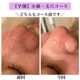 Bellesthe （ベルエステ）のエステ・リラクイメージ