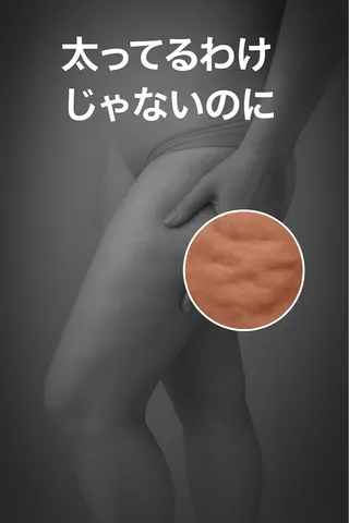 美容整体・塗る漢方・フェイシャルRechica所属・心斎橋痩身 美肌整体サロン💓のエステ・リラクイメージ