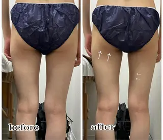 ENCHANT 脱毛.小顔.毛穴のエステ・リラクイメージ