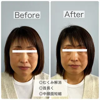 GAGA D  Ash所属・GAGA D Ashのヘアスタイル