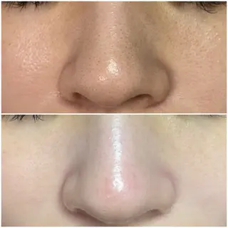 Salon Lily MARIのエステ・リラクイメージ