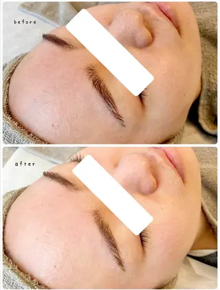 【医療提携サロン】Mbelle所属・フェイシャルサロン 三沢のその他イメージ