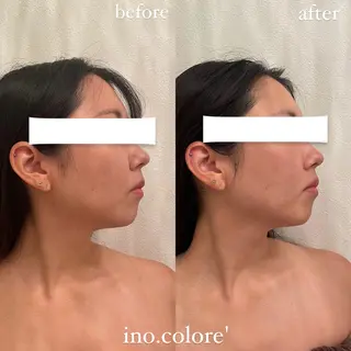 エステサロンino.colore'所属・小顔サロン ino.coloreのエステ・リラクイメージ