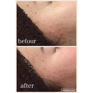 ニキビ跡専門サロン Ａｉｎａのエステ・リラクイメージ