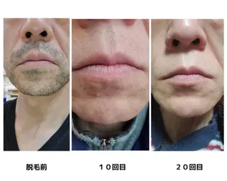 Lilas所属・迫原 麻衣のエステ・リラクイメージ