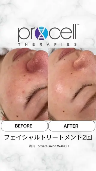 WARCH Marieのその他イメージ