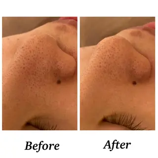 Bellesthe （ベルエステ）のエステ・リラクイメージ