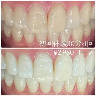 メンズ ホワイトニングルーム　川崎店所属・ホワイトニング ルーム　川崎店のその他イメージ