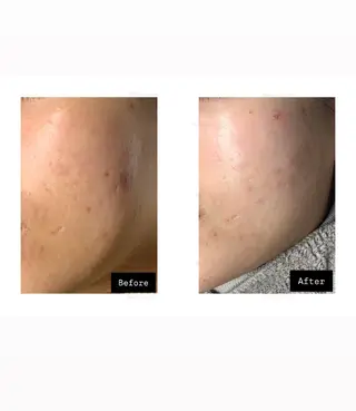 BIOLUXE BEAUTY所属・バイオラックス ビューティーのエステ・リラクイメージ