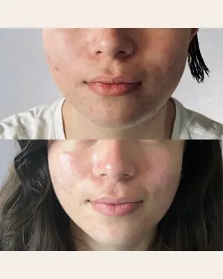 美腸サロン🌺 腸もみ/小顔/リンパのエステ・リラクイメージ