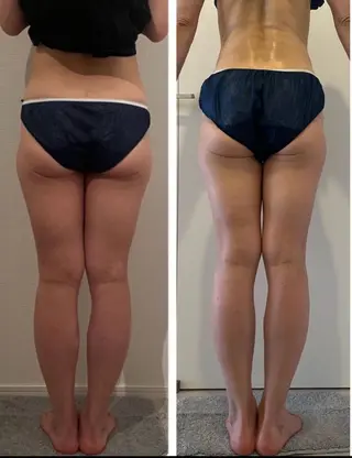 M.plus エムプリュ所属・よもぎ蒸し、セル撃退 専門店M.plusのエステ・リラクイメージ