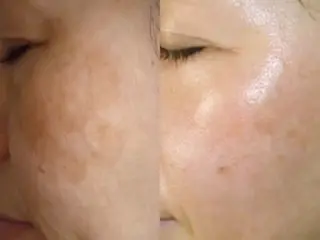 諸葛 涼のエステ・リラクイメージ