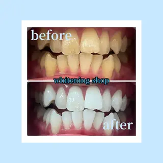 ホワイトニングショップ光明池店所属・ホワイトニング ショップ光明池店のその他イメージ