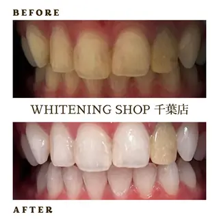 メンズ ホワイトニング ショップ千葉店のその他イメージ
