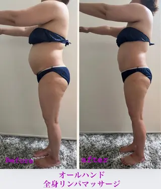 ピーリング＆脱毛 maoのエステ・リラクイメージ