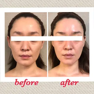 美ola ビオラのエステ・リラクイメージ