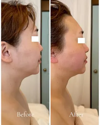 Lani Moon所属・⟡ 京都 小顔  ⊹ Lani Moonのエステ・リラクイメージ