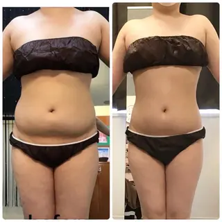 レイビス八戸店 村山のエステ・リラクイメージ