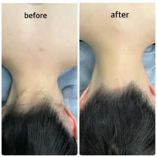 ulu-fu所属・脱毛ulu-fu 植村のエステ・リラクイメージ