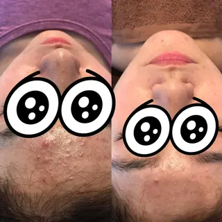 はりすたいる 鍼灸院のエステ・リラクイメージ