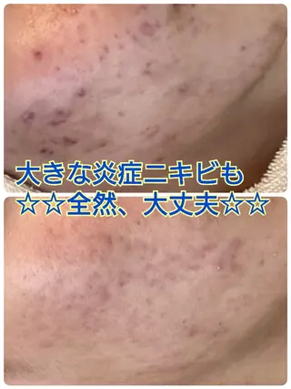 メンズ ハーブピーリング 専門店Kikkaのエステ・リラクイメージ