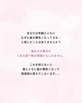 セルフホワイトニング エクシア大曽根店のその他イメージ