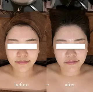 NOEL所属・フェイシャルエステ Utaiのエステ・リラクイメージ