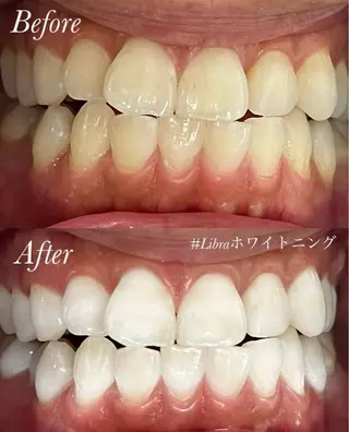 Libra所属・Libra 脱毛/ホワイトニングのその他イメージ