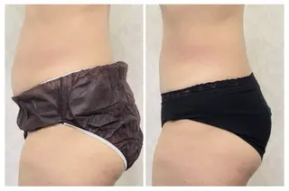 ビューティーサロン ティファニー横浜店のエステ・リラクイメージ