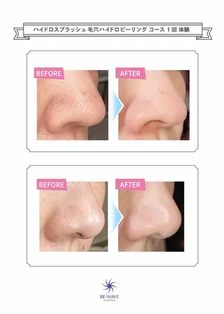 リオッサ  オブ ラグーン神戸店のエステ・リラクイメージ