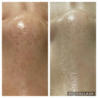 ハーブピーリング 専門／今榮麻美のエステ・リラクイメージ